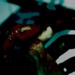 bleeding hand